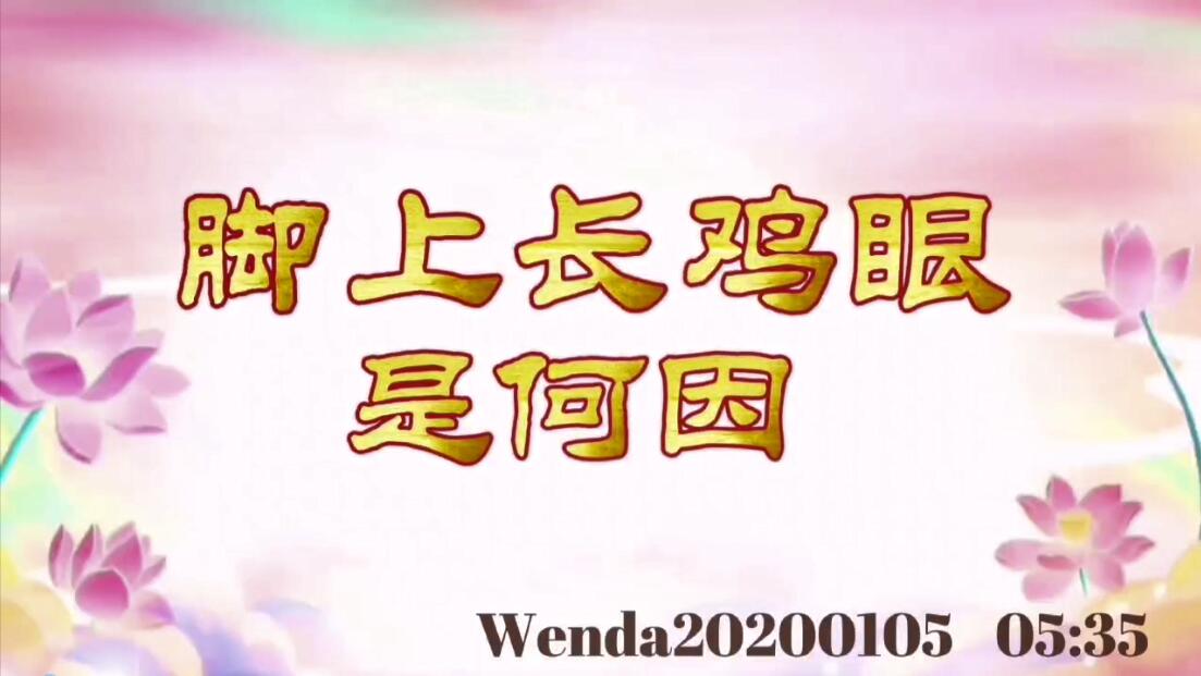脚上长鸡眼是何因 wenda20200105_0535